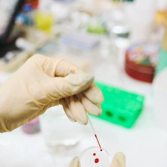 Lab Results Review